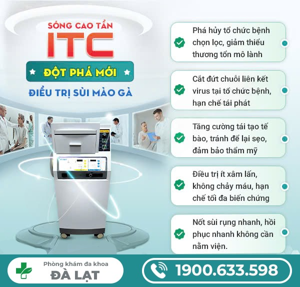 Hình ảnh minh họa